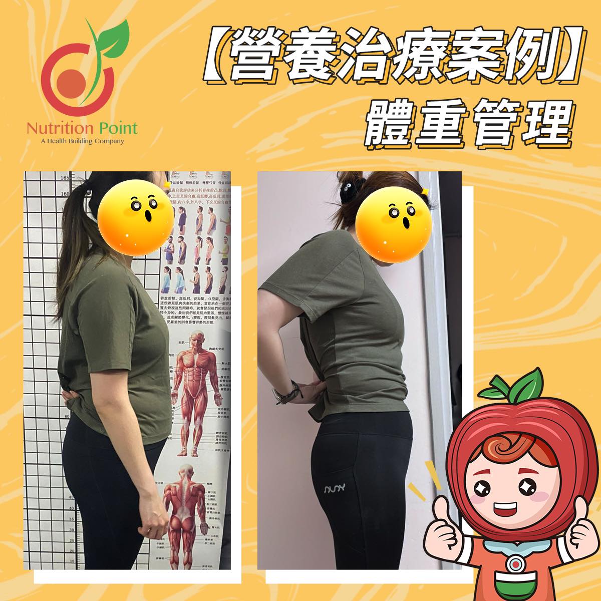 【營養治療案例】體重管理