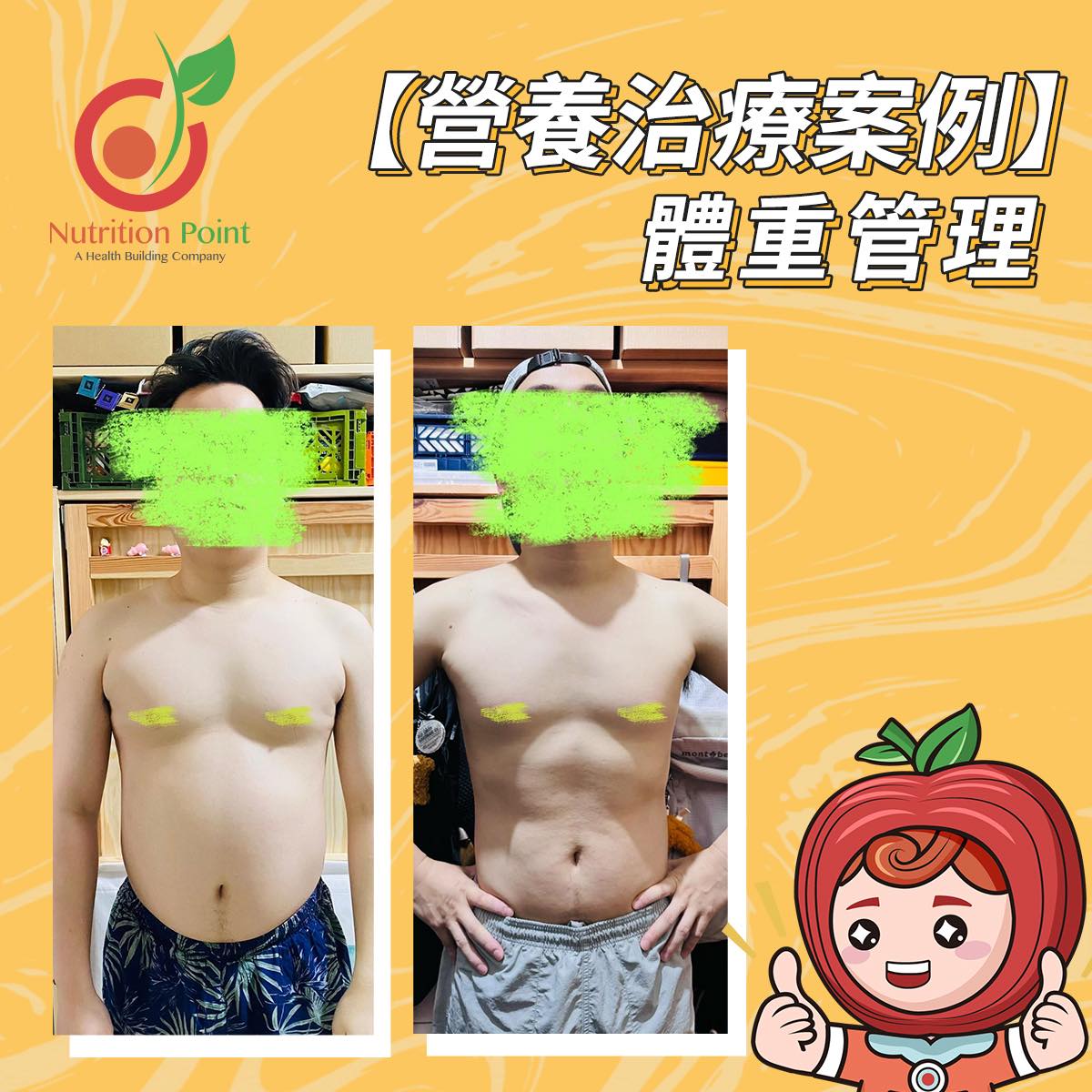 【營養治療案例】體重管理