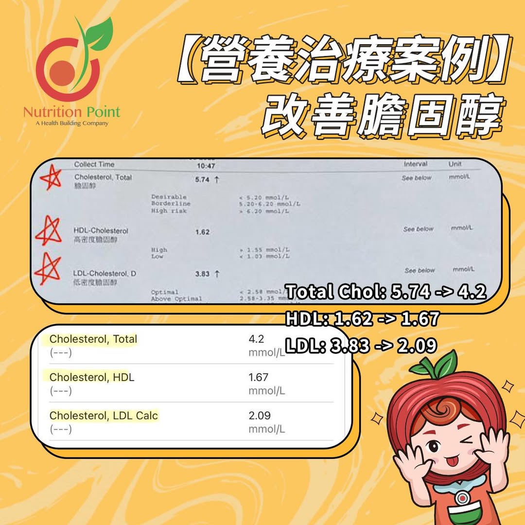 【膽固醇踩界?】食得清淡都出事!解開 B1 體質的「儲脂密碼」 【膽固醇踩界?】食得清淡都出事!解開 B1 體質的「儲脂密碼」