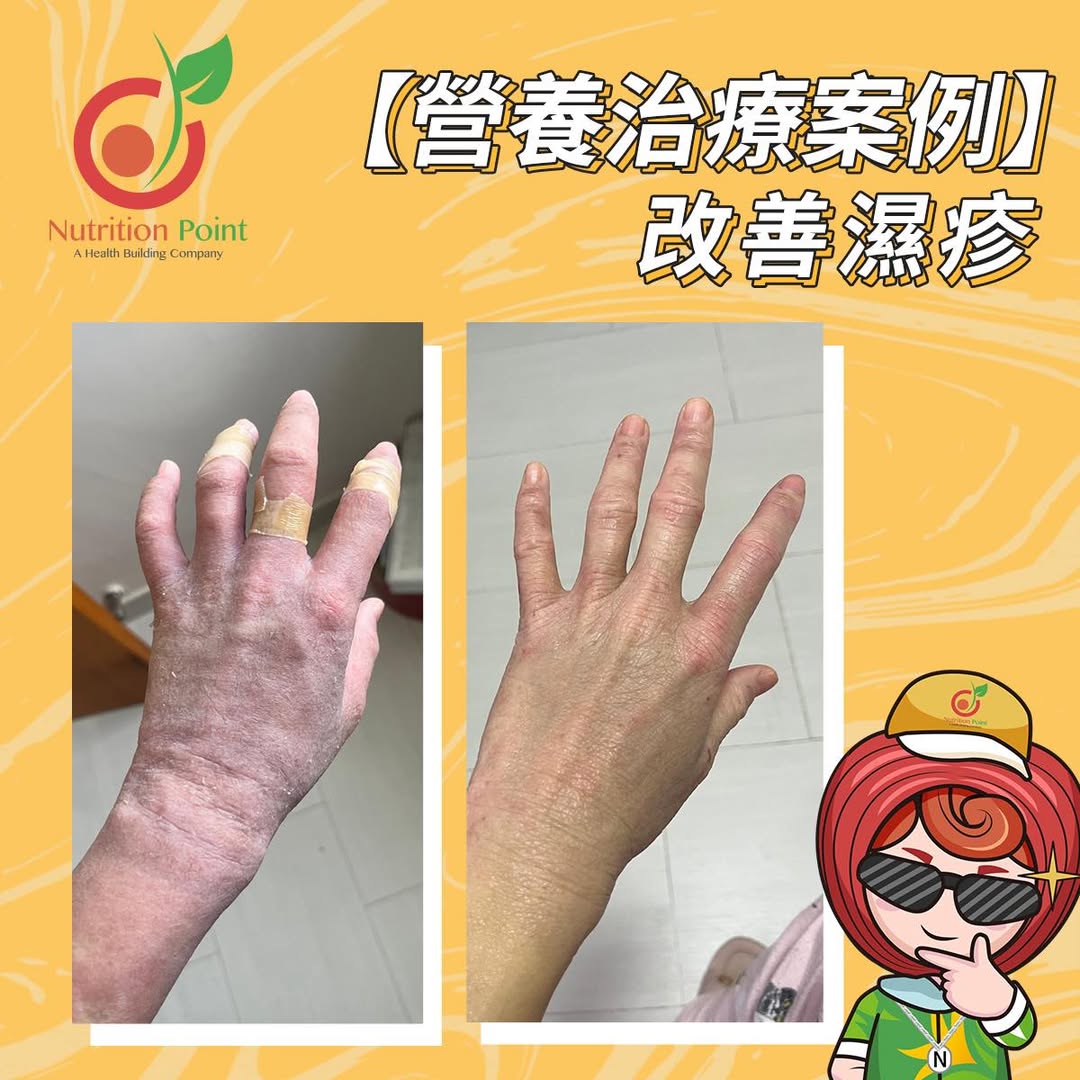 【個案分享:食得清淡都出事?可能係體質錯配!】 【個案分享:食得清淡都出事?可能係體質錯配!】