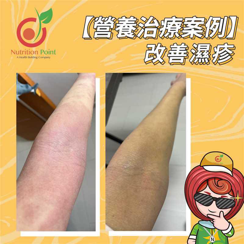 【案例分享】跟住體質食，8 星期靚返晒！