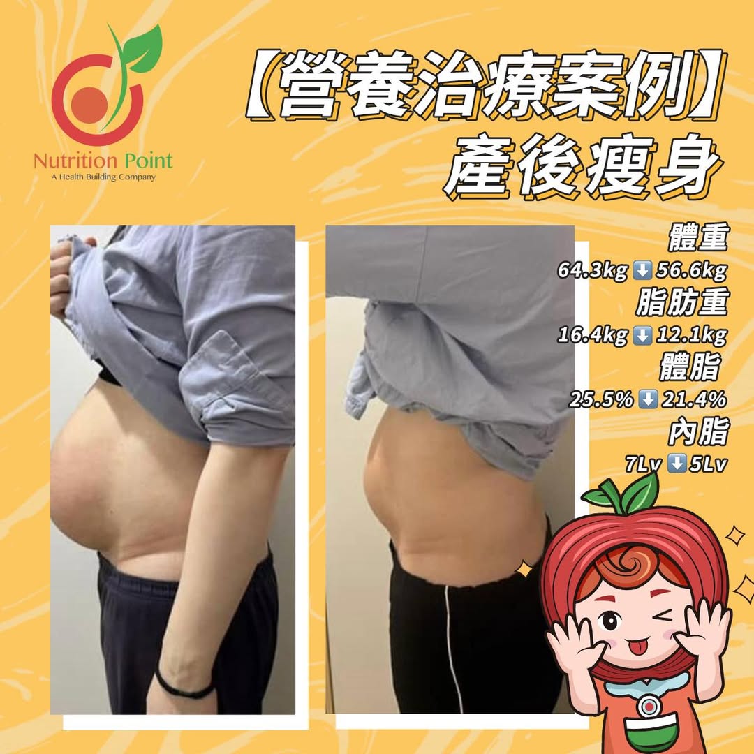 產後肚腩難消？營養師揭秘3大原因與B1型體質的修身方案